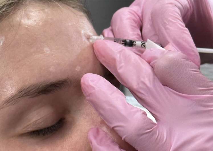 Botox & Wrinkle Reducers